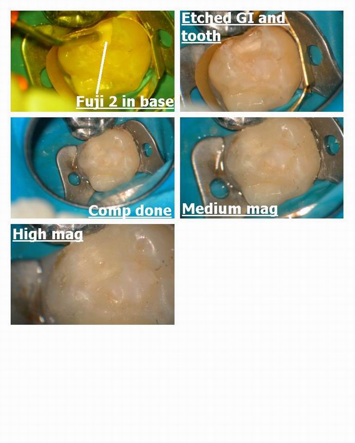 Pulpotomy pg 2.jpg